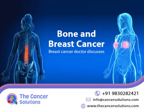 Bones and Breast Cancer- Breast Cancer Surgeon Discusses