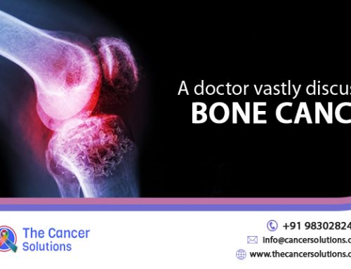 A doctor vastly discussed bone cancer