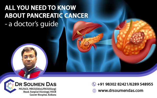 best pancreatic cancer doctor in Kolkata