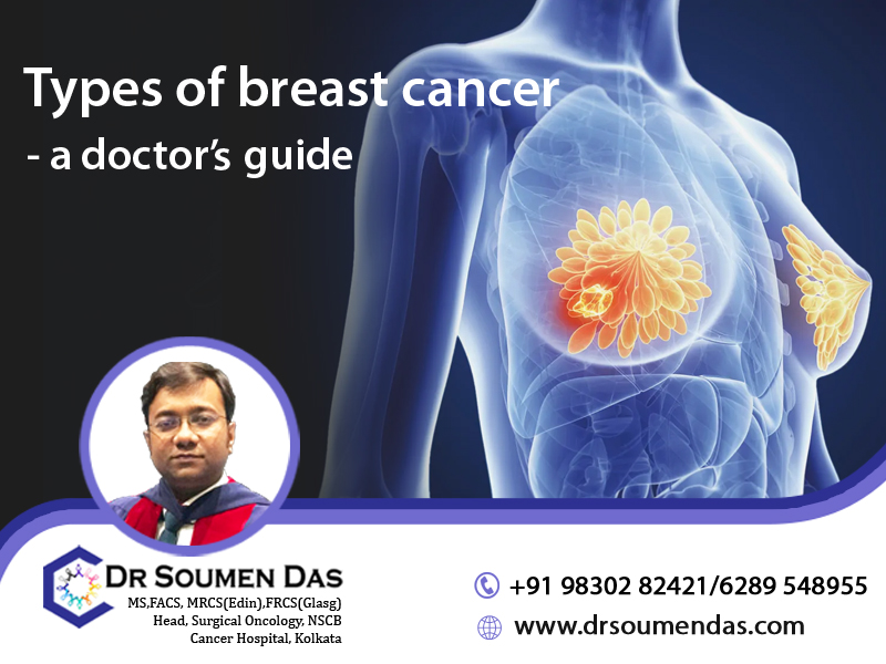 best breast cancer doctor in Kolkata