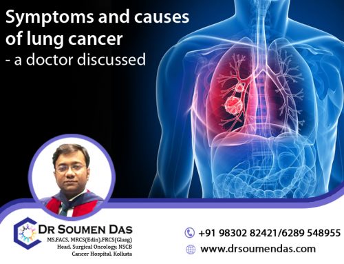 Symptoms and causes of lung cancer- a doctor discussed