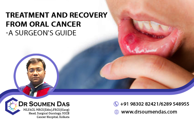oral cancer treatment