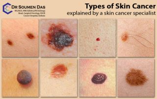 skin cancer doctor