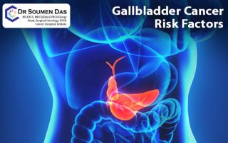 gallbladder cancer doctor