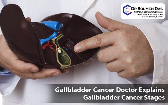 gallbladder cancer doctor