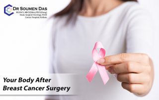 Breast Cancer Surgery