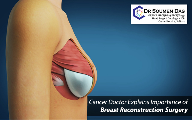 Breast Cancer Surgery in Kolkata