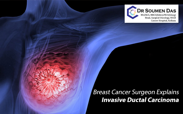 Breast Cancer Treatment in Kolkata