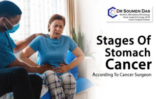 Stages of Stomach Cancer