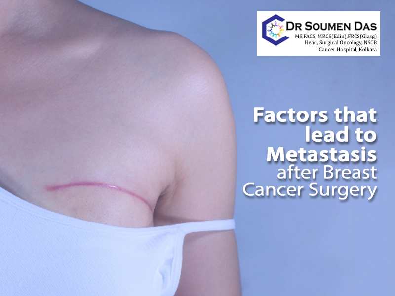 factors lead to metastasis after breast cancer surgery in kolkata