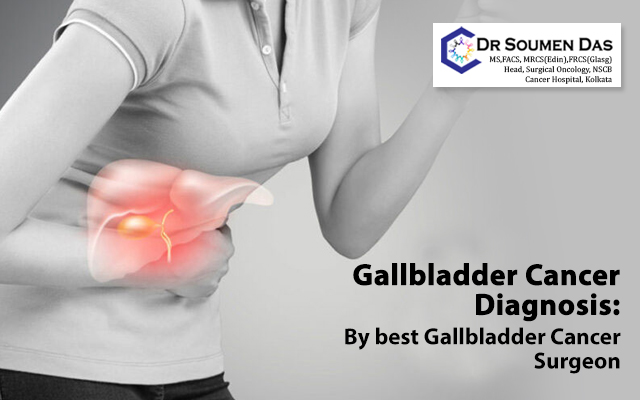 Gallbladder cancer diagnosis
