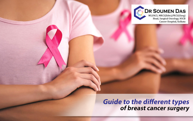 breast cancer surgery in kolkata