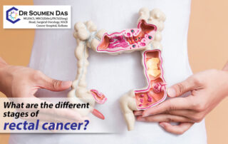 colon and rectal cancer surgeon in kolkata