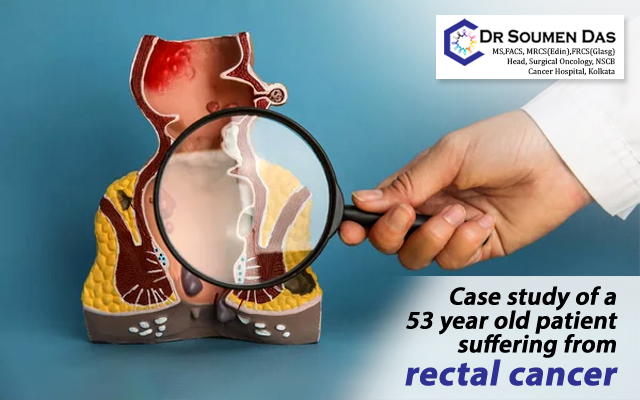 rectal cancer treatment