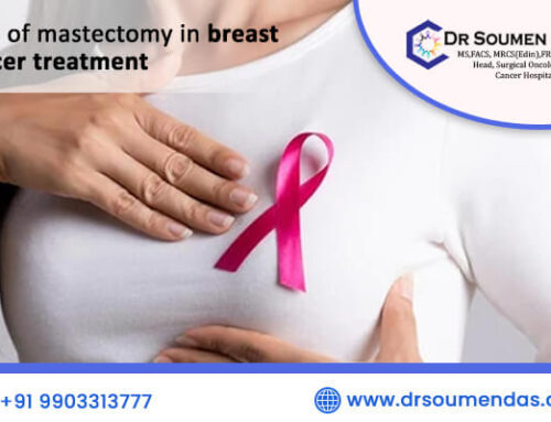 Role of mastectomy in Treatment of breast cancer