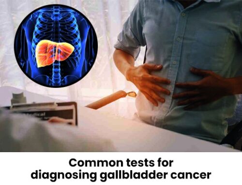 Common tests for diagnosing gallbladder cancer