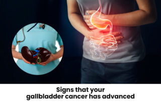 gallbladder cancer