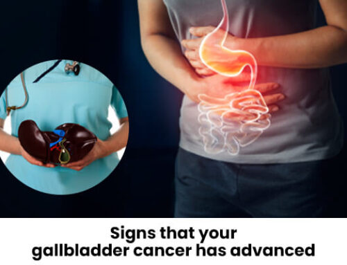 Signs that your gallbladder cancer has advanced