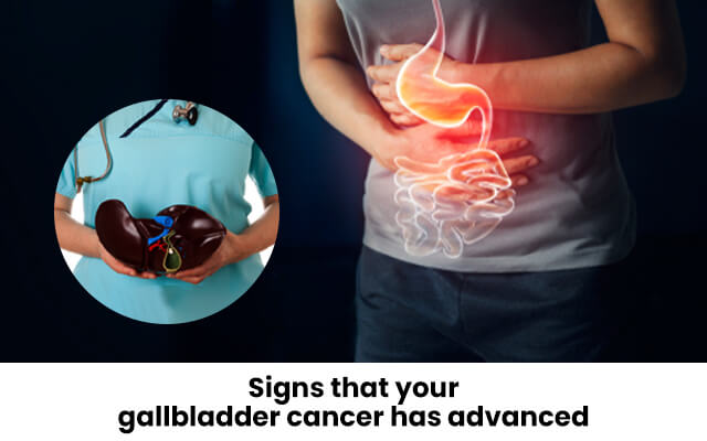 Signs that your gallbladder cancer has advanced