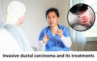 Invasive ductal carcinoma