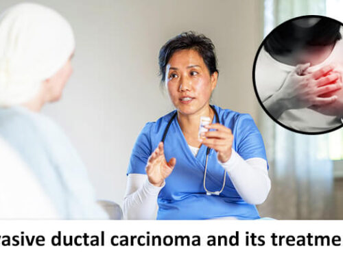 Invasive ductal carcinoma and its treatments