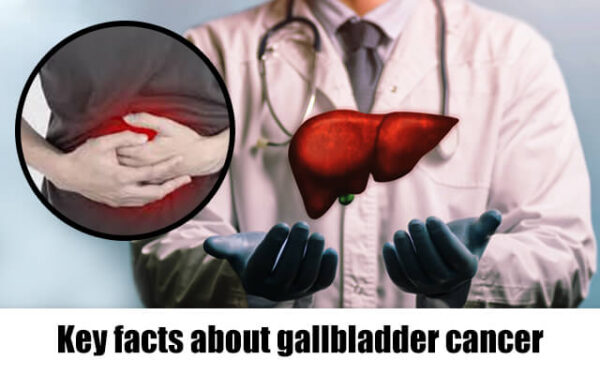 Key facts about gallbladder cancer
