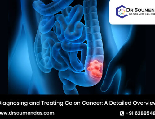 Diagnosing and Treating Colon Cancer: A Detailed Overview
